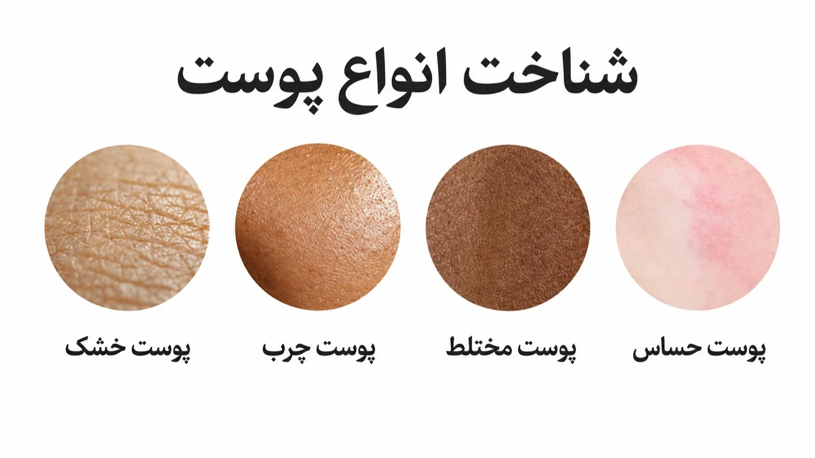 شناخت انواع پوست برای ارایش شناخت انواع پوست